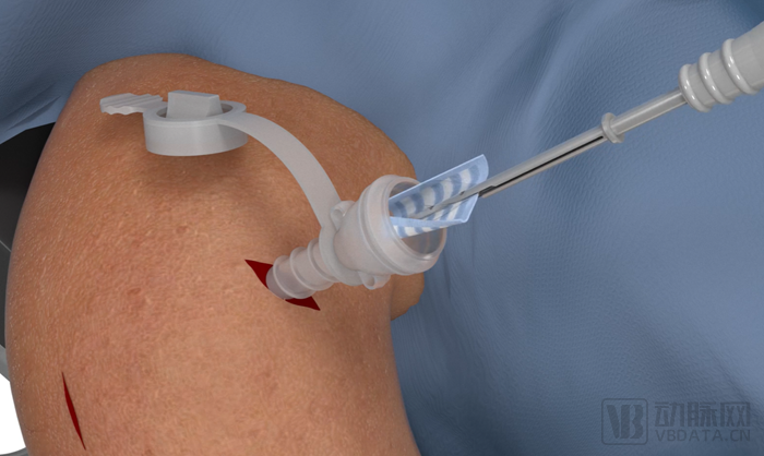 640 (6).png 640 (6).png